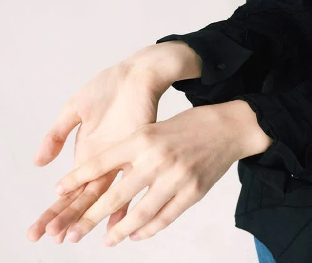 手指、掰手指、关节炎-康兴医疗器械官网