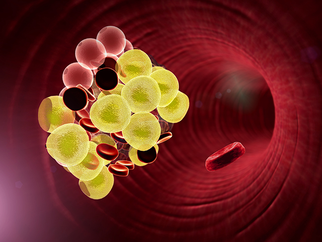 脂肪、内脏、血液-康兴医疗器械官网